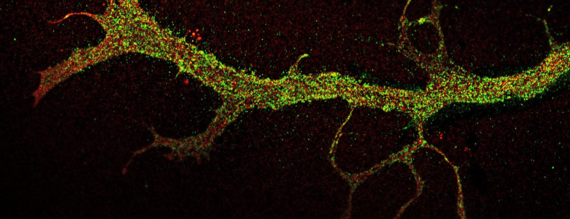 green dots as signs of critical molecular regenerating receptors